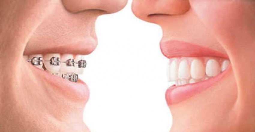 ortodontiın faydaları nelerdir